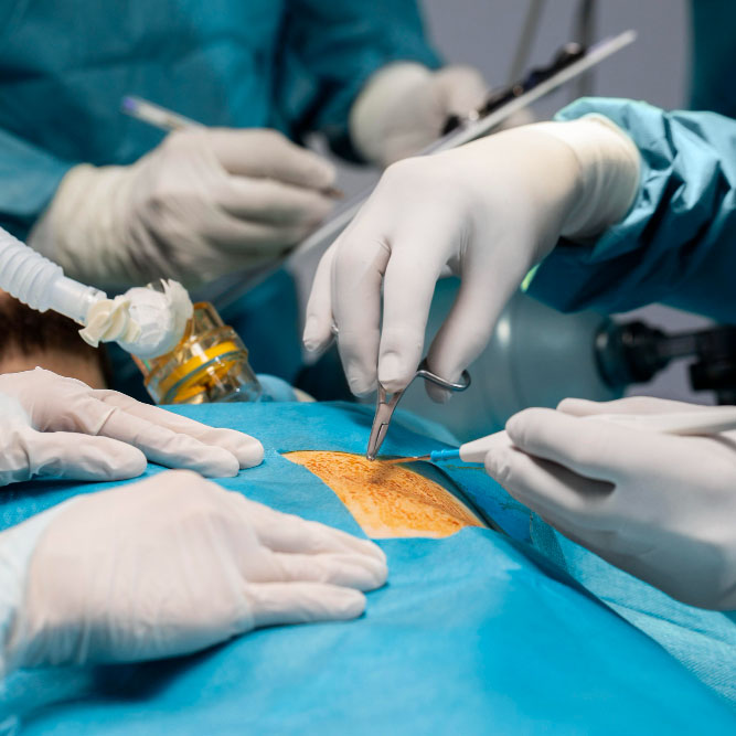 hpb oncologic surgery.jpg