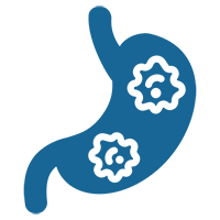 gastric and stomach cancer.webp