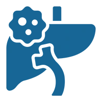 liver and bile duct cancer.webp