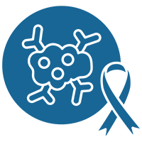 periampullary cancer.webp
